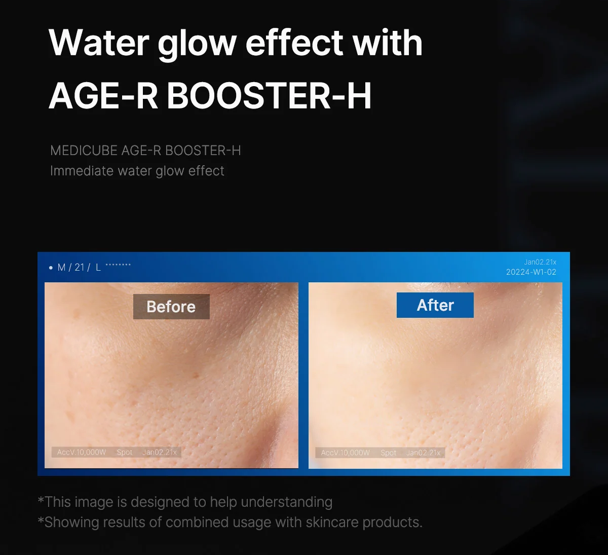 AGE-R Booster-H (Glow Effect) pre-order