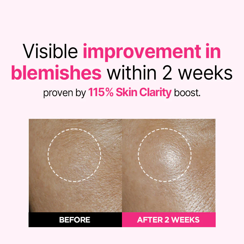 Blemish Care Up Serum