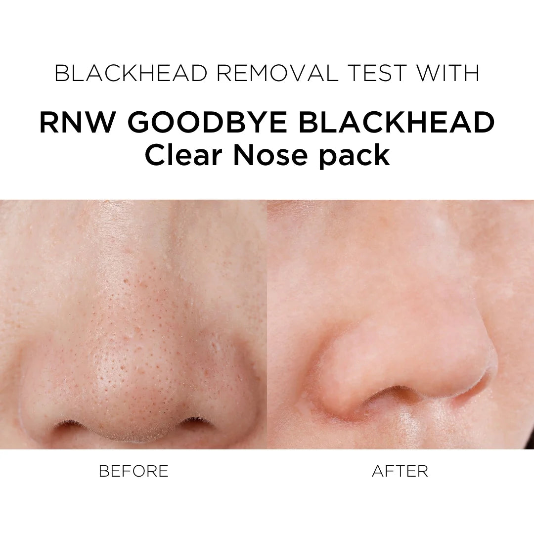 Natural Mild Clear Nose Pack + Deep Clean Master Set