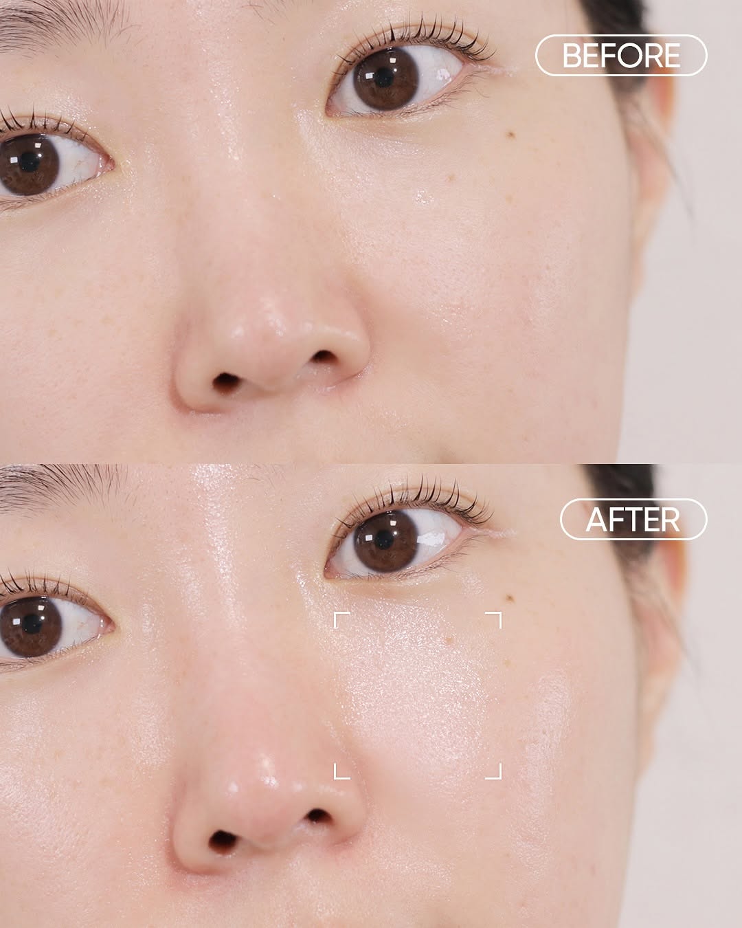Probioderm Collagen Remodeling Serum Set 3pc (30ml+30ml+20ml)