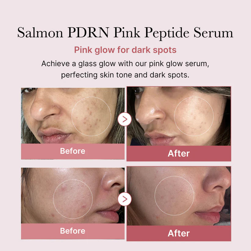 PDRN Pink Peptide Serum (30ml + 30ml)