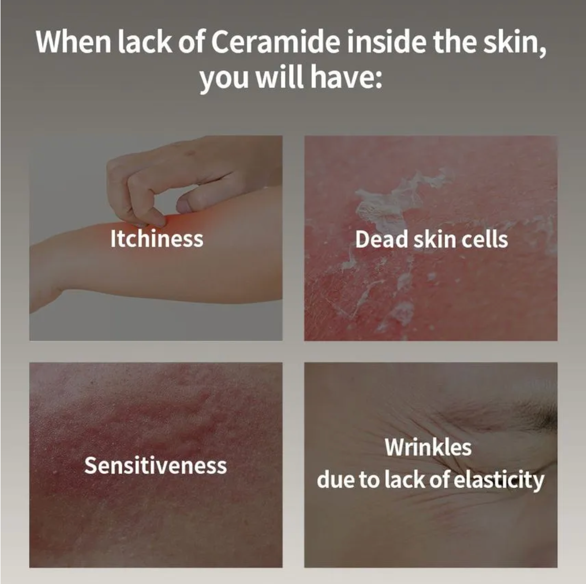 Ceramide Cream 10000ppm