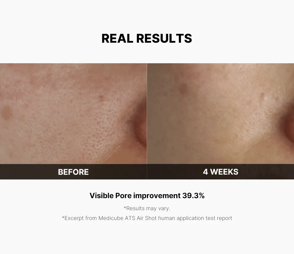 AGE-R ATS Air Shot (needle-free pore care)