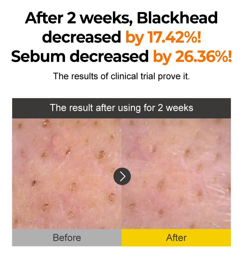 No.1 Easy Peasy Cleansing Oil