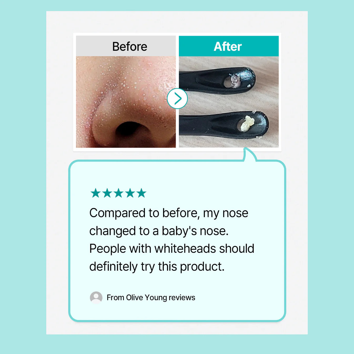Natural Mild Clear Nose Pack + Deep Clean Master Set