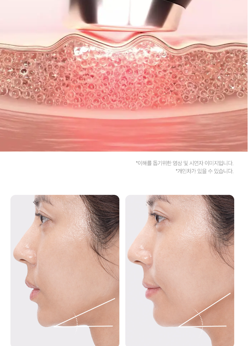 AGE-R Booster Pro (pre-order)