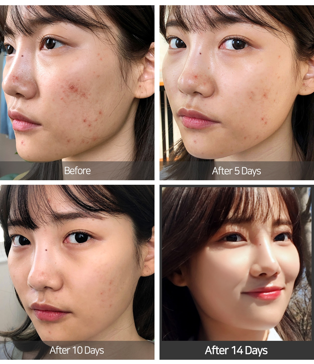 AHA BHA PHA 14 Days Super Miracle Spot All Kill Cream 30ml