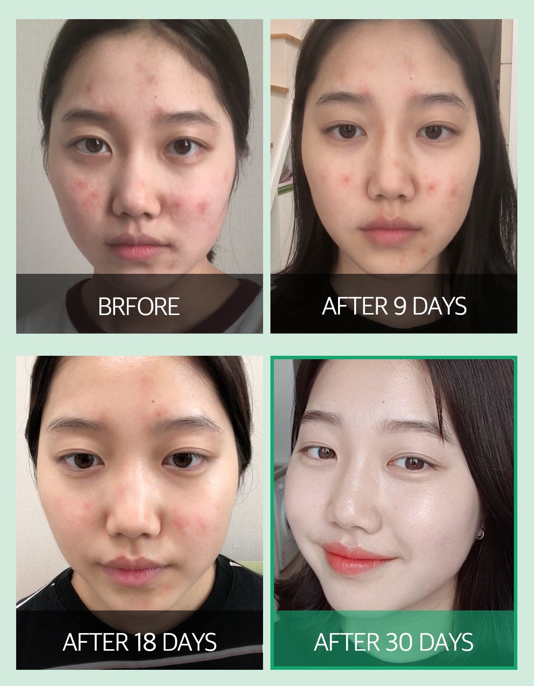 AHA BHA PHA 30 Days Miracle Serum 50ml