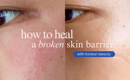 How to Heal a Broken Skin Barrier (with Korean skincare)
