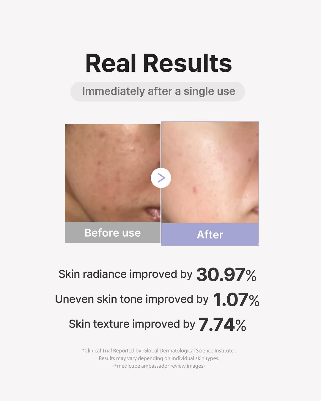 AGE-R Mini Booster Pro (2 colours) pre-order