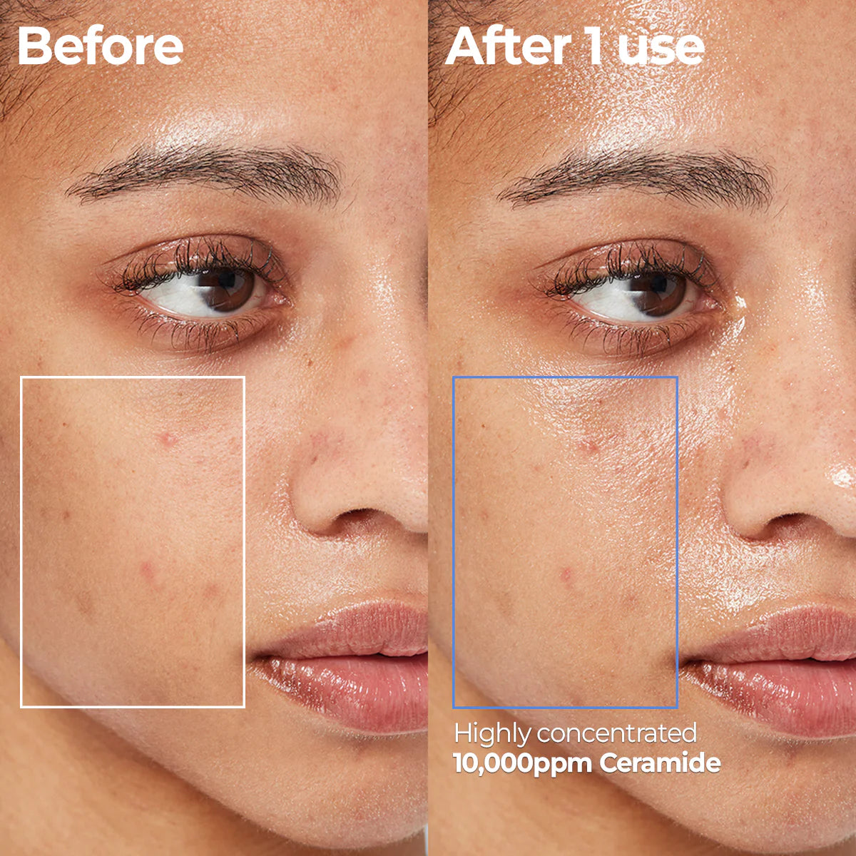 ATOBARRIER365 Cream Mist