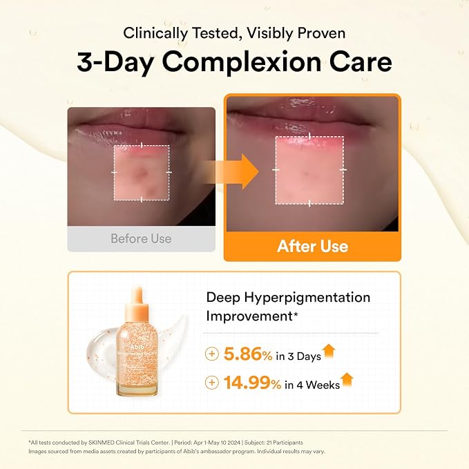 Glutathiosome Dark Spot Serum