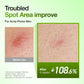 Azelaic Acid 10 Hyaluron Redness Soothing Serum