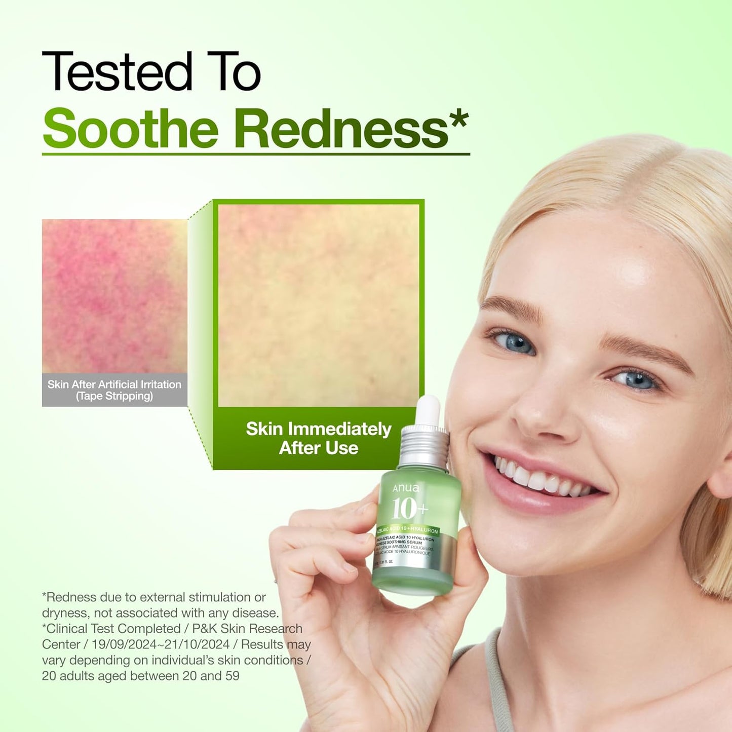 Azelaic Acid 10 Hyaluron Redness Soothing Serum