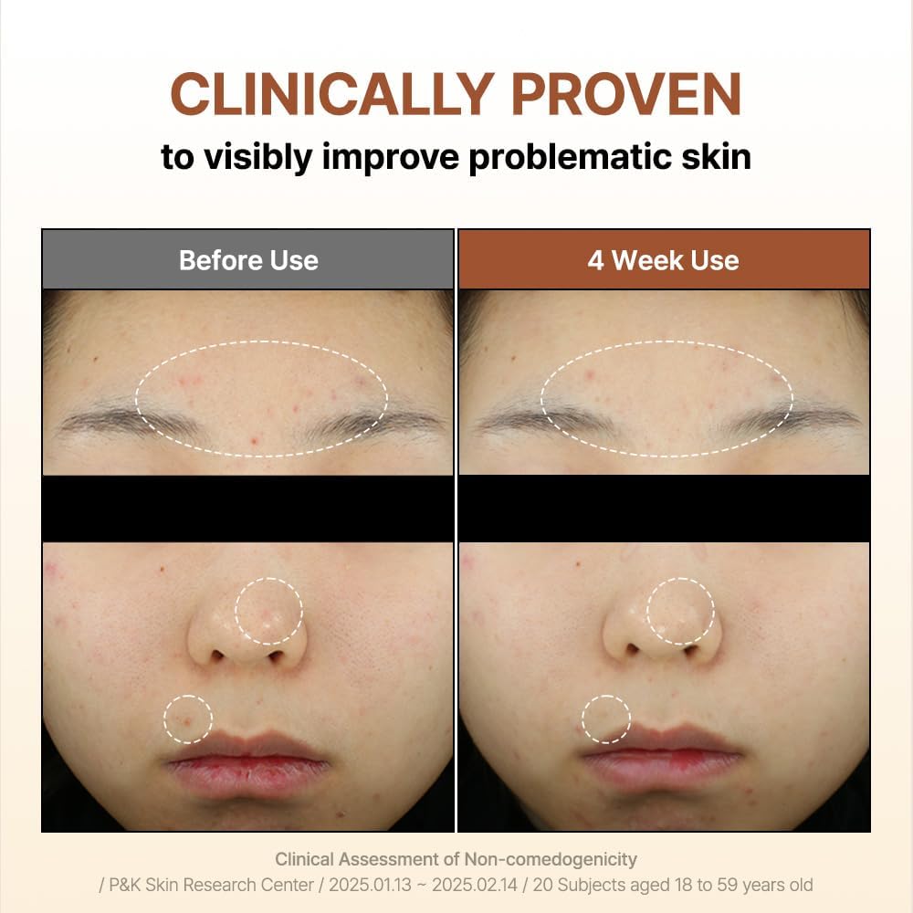 Mandelic Acid 5% Skin Prep Water