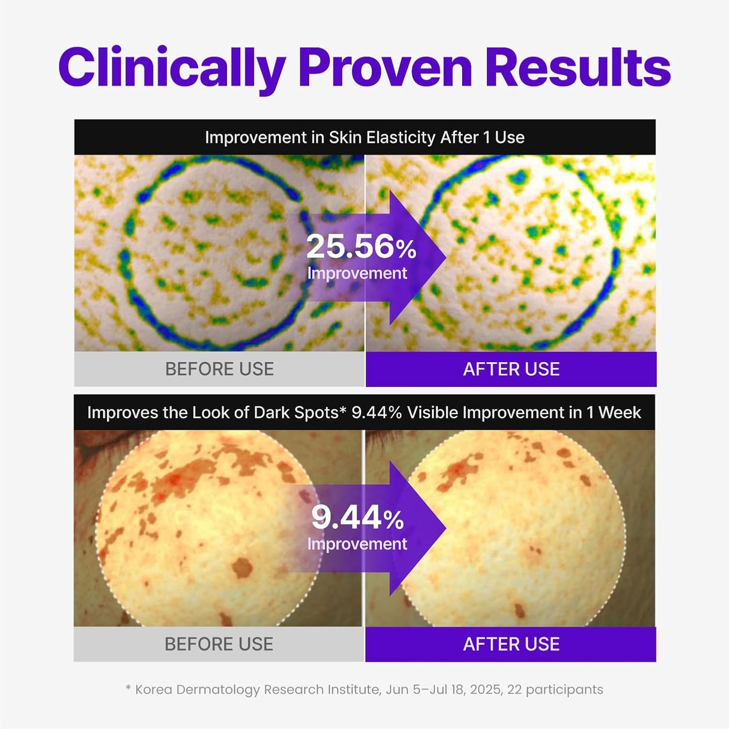 Expert Madeca Cream Active Renew PDRN