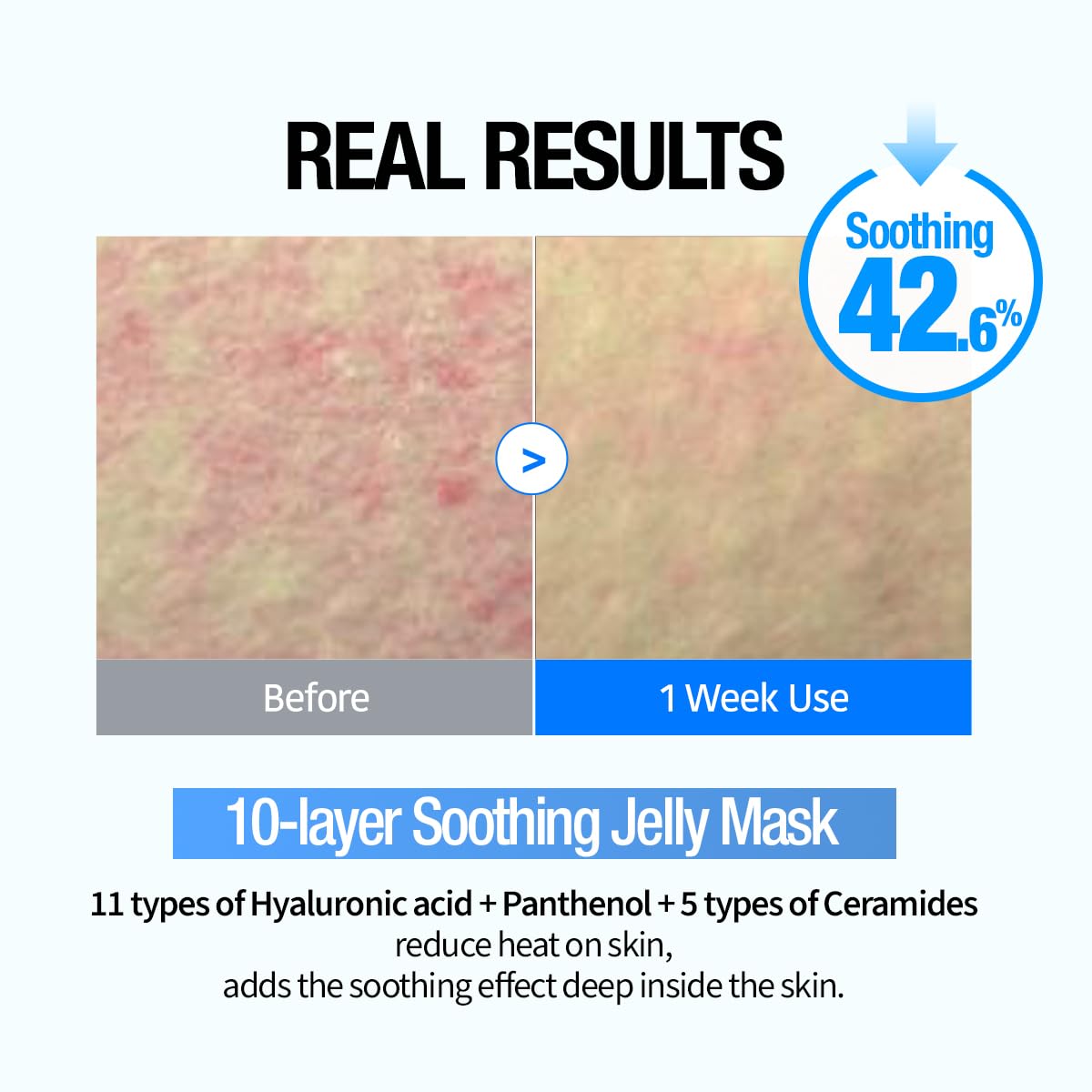 Heartleaf Hyaluron Soothing Jelly Sheet Mask