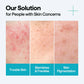 Madecassoside Blemish Repair Serum