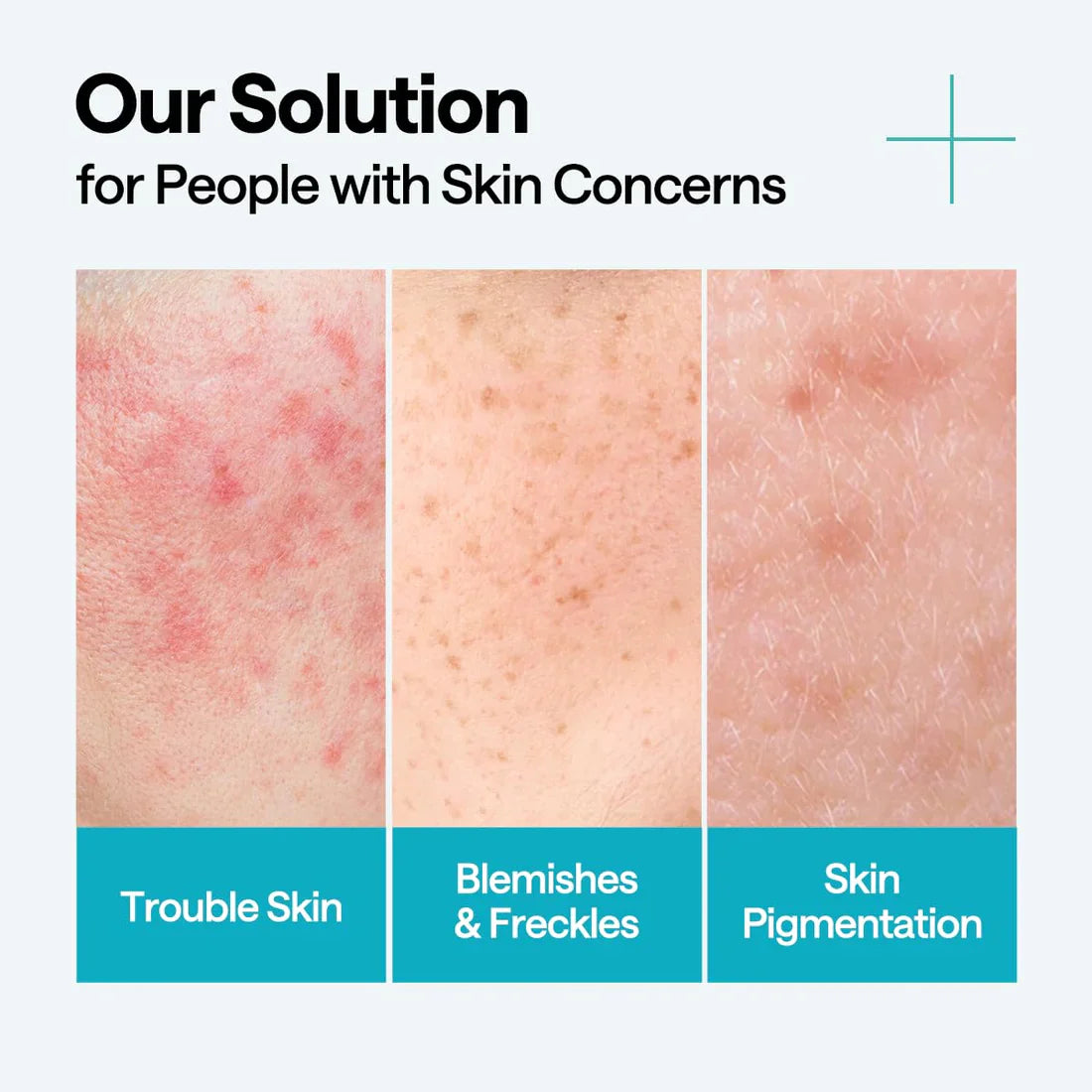 Madecassoside Blemish Repair Serum