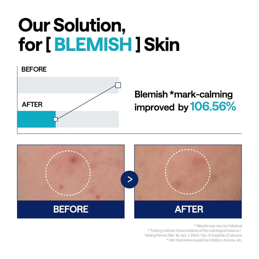 Madecassoside Blemish Repair Serum