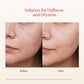 Facial Treatment Mask 1pc