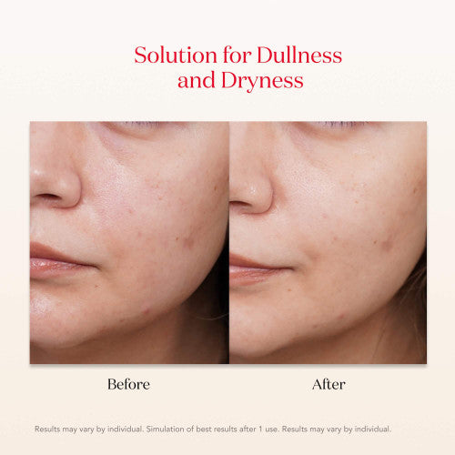 Facial Treatment Mask 1pc