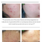 Nosca9 Trouble Serum