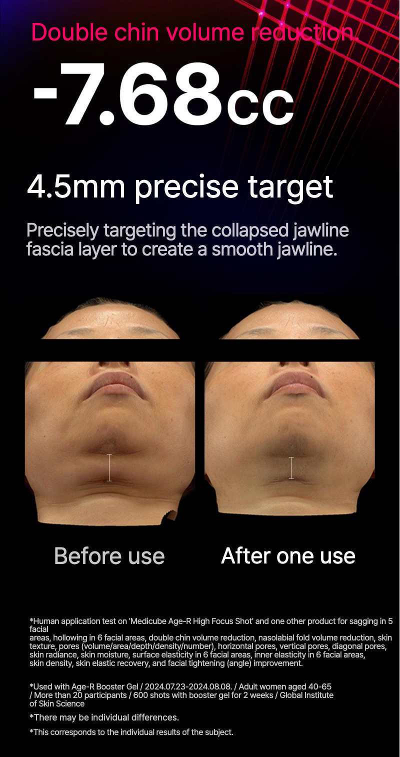 High Focus Shot (pre-order)