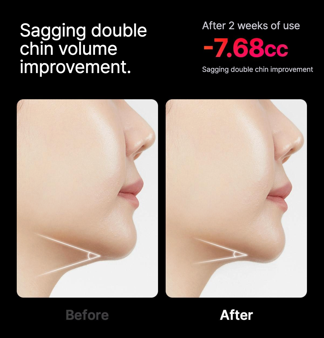 High Focus Shot (pre-order)