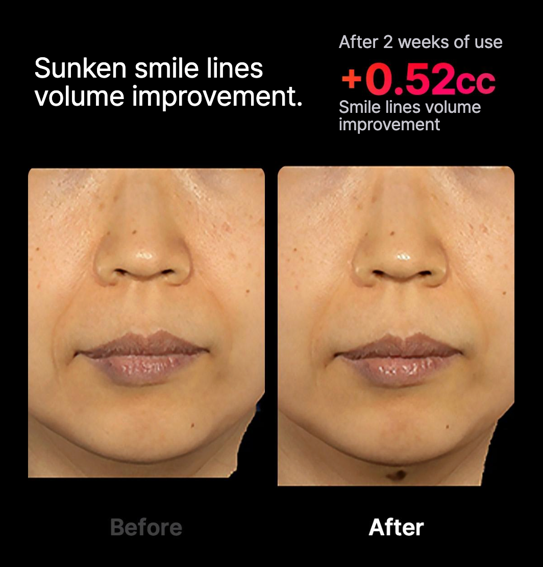 High Focus Shot (pre-order)