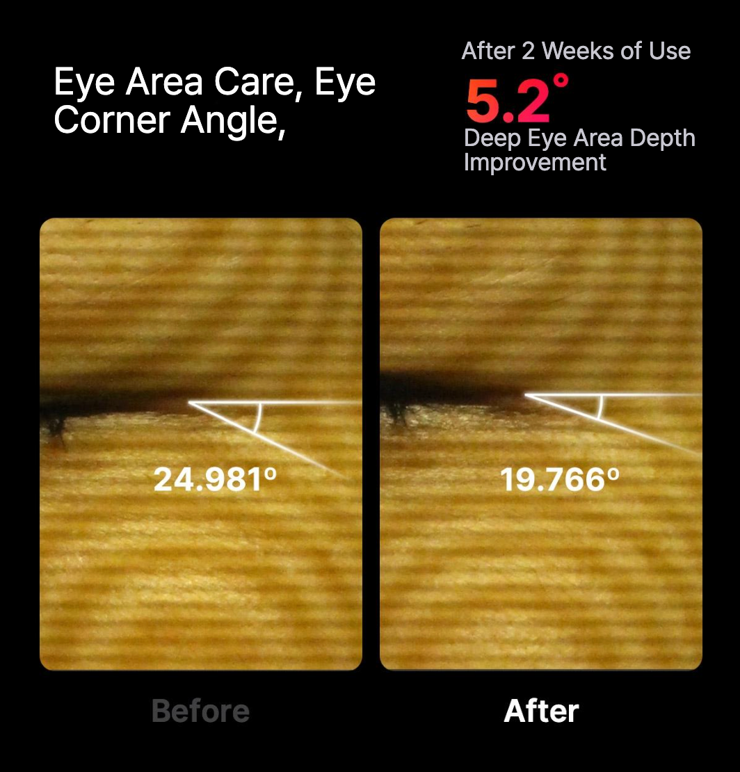 High Focus Shot (pre-order)