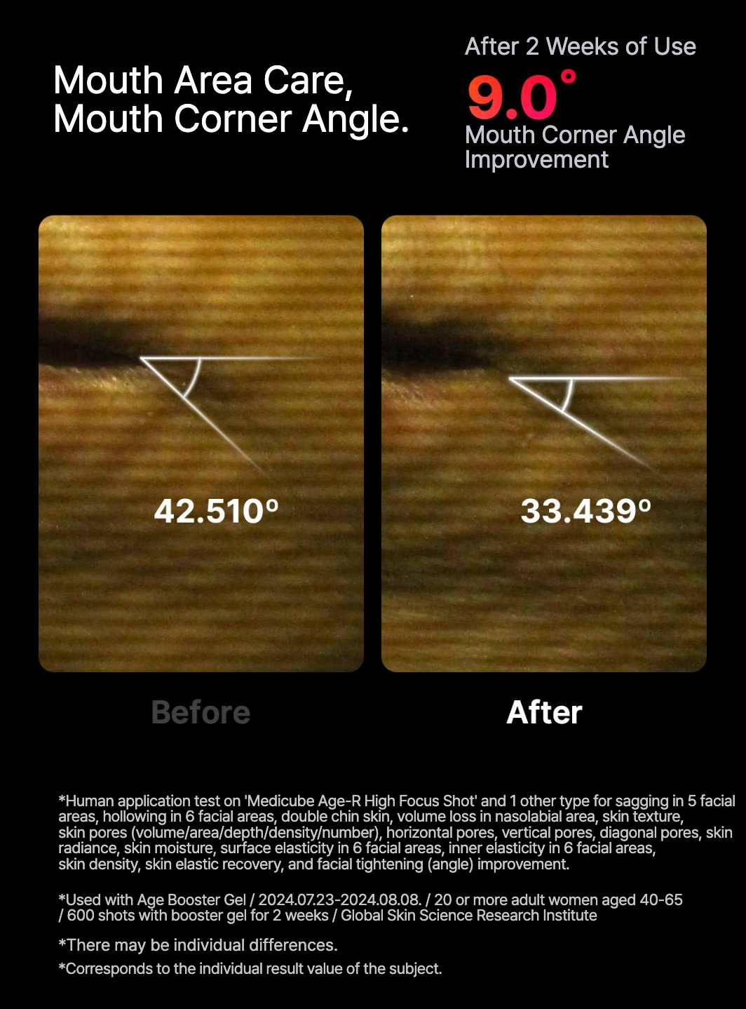 High Focus Shot (pre-order)