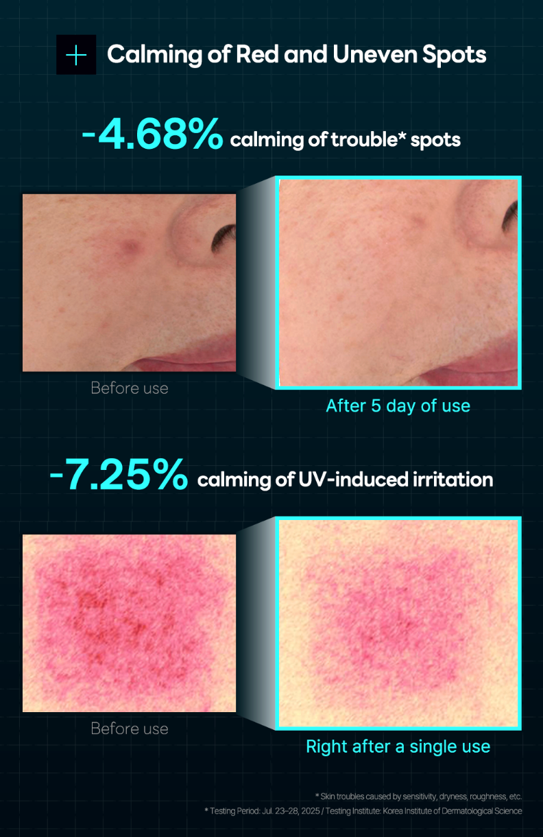 Madecassoside Derma Cream