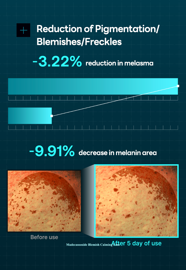 Madecassoside Derma Cream