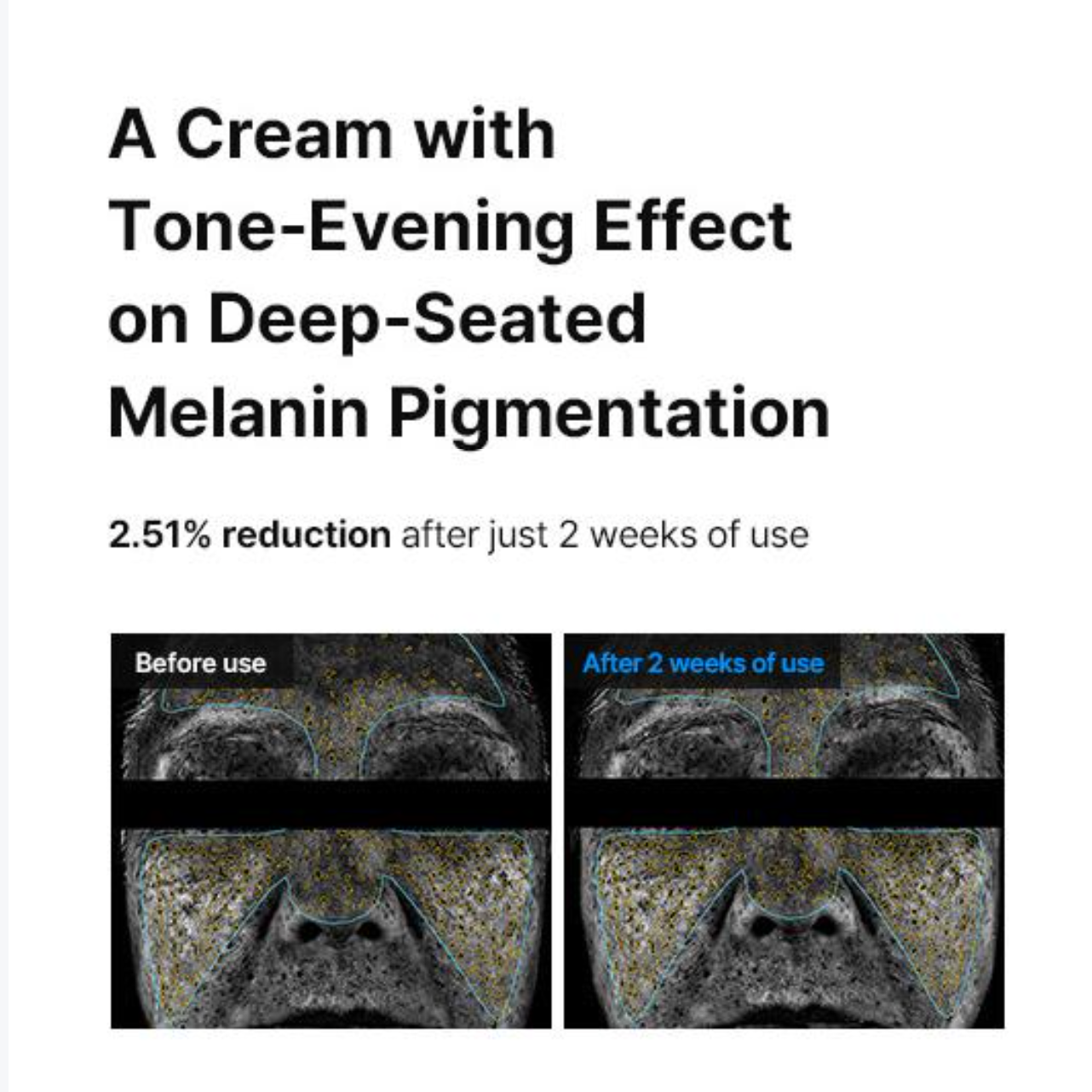 Pigmentation Pro Cream