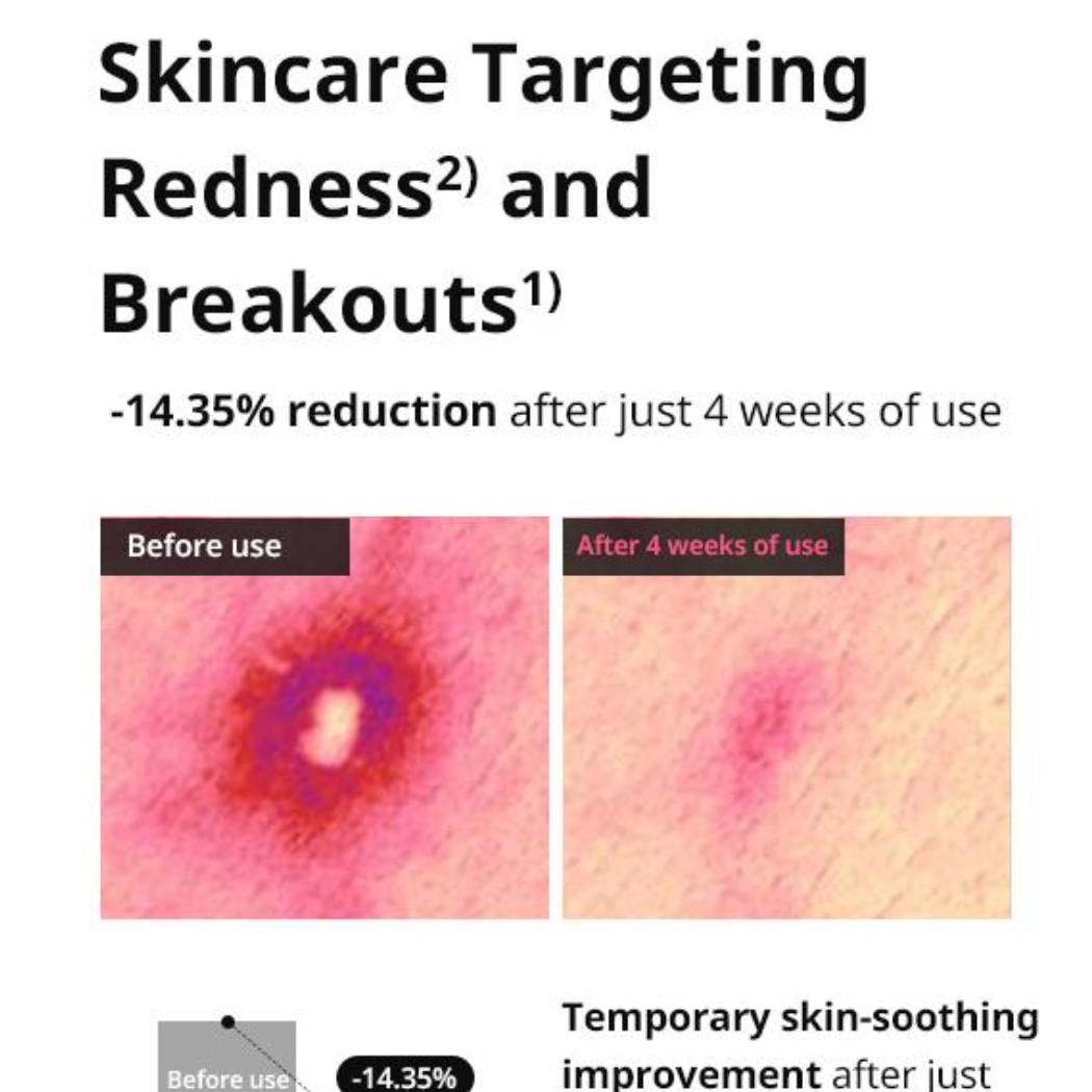 Acne Pro Cream