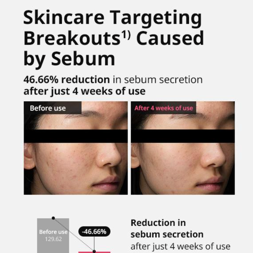 Acne Pro Cream