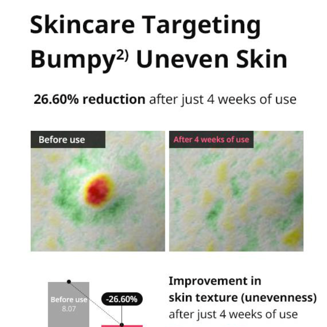 Acne Pro Cream