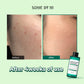 AHA BHA PHA Calming Truecica Micellar Cleansing Water
