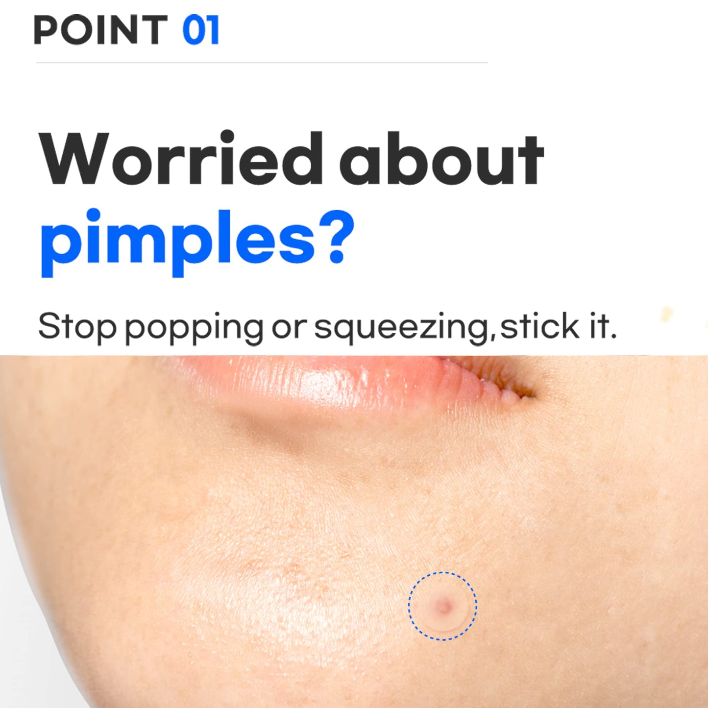 Surprise B Spot Patch (24 patches)