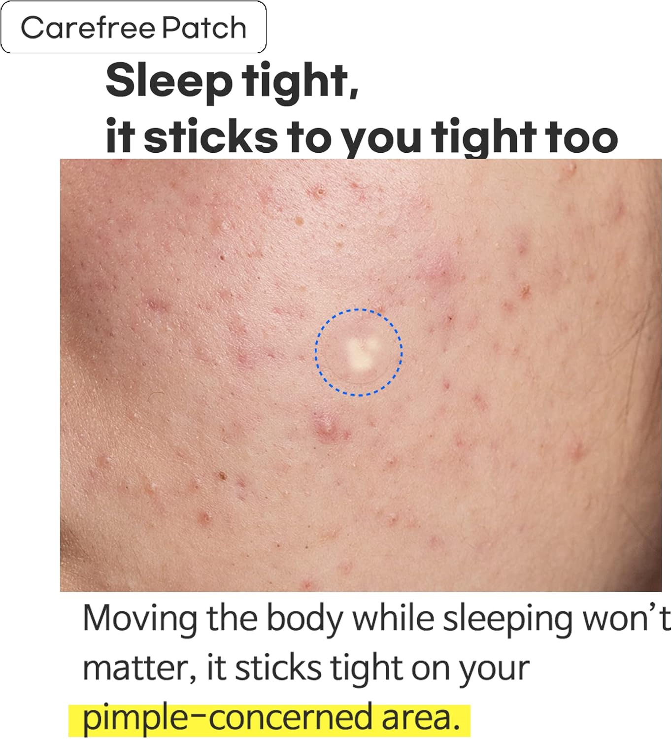 Surprise B Spot Patch (24 patches)