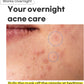 Surprise B Spot Patch (24 patches)