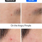 Surprise B Spot Patch (24 patches)