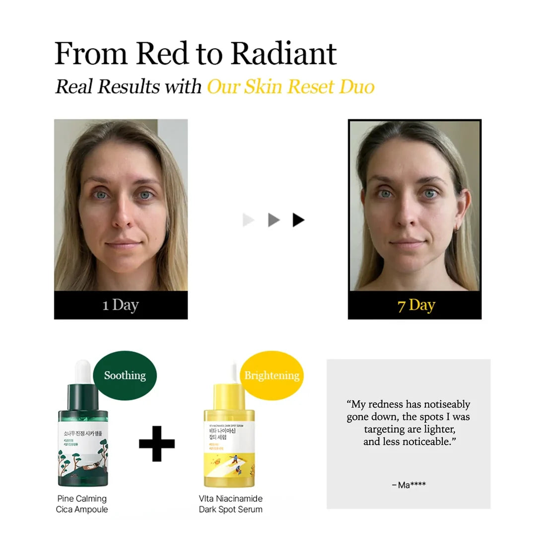Vita Niacinamide Dark Spot Serum