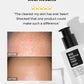 BHA Blackhead Power Liquid