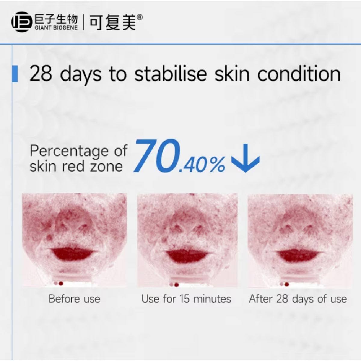 Recombinant Collagen Renewing Soothing Essence Mask