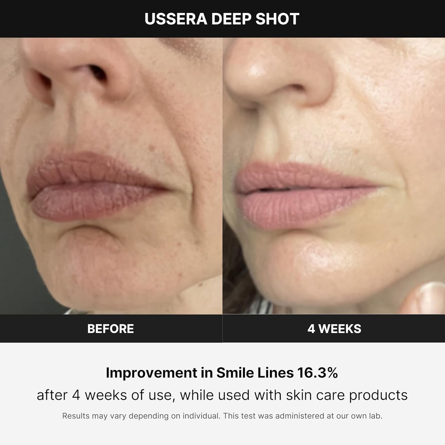 AGE-R USSERA Deep Shot