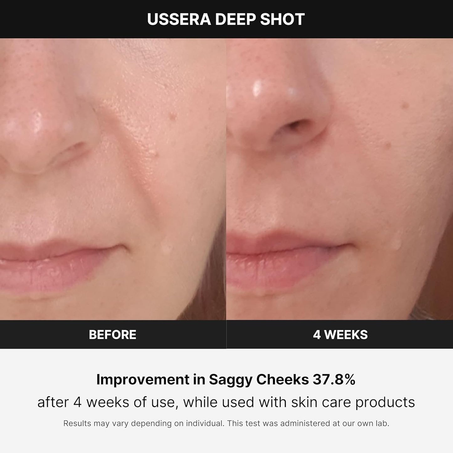 AGE-R USSERA Deep Shot