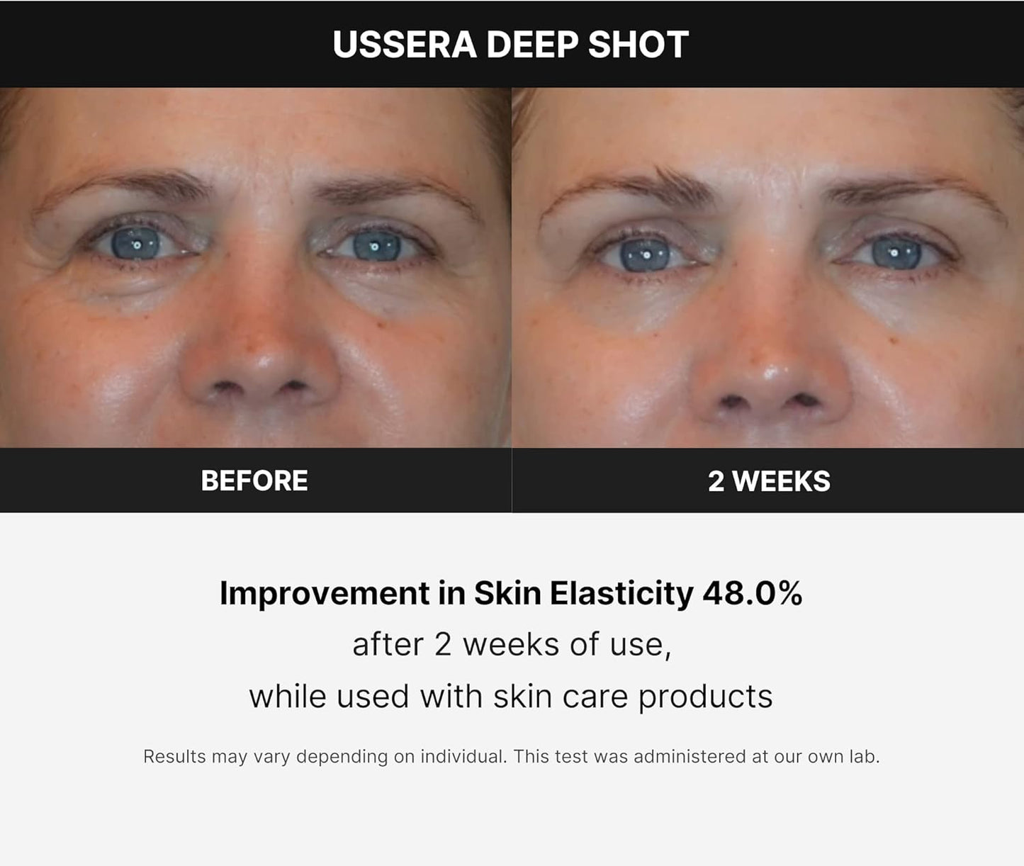 AGE-R USSERA Deep Shot