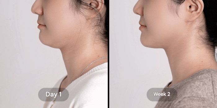 Booster V-Roller (pre-order)